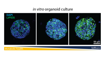 organoids and stiffness