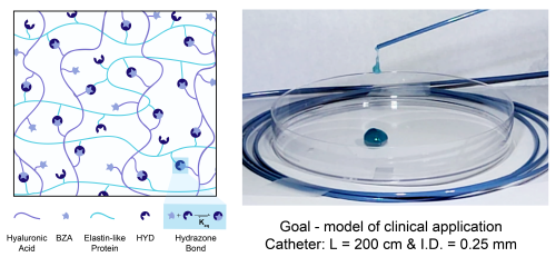catheter injection of hydrogel