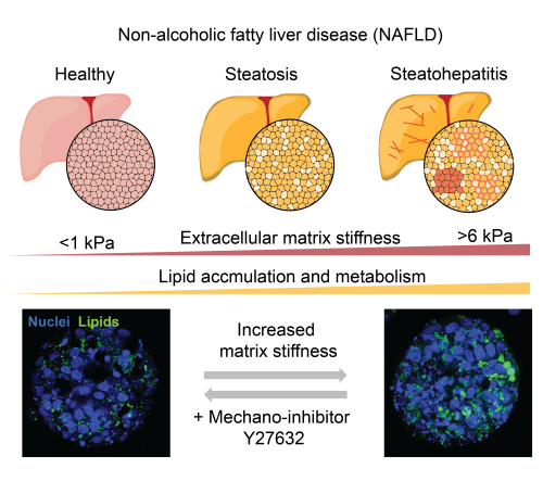 Fatty Liver